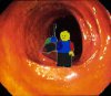colon2.jpg